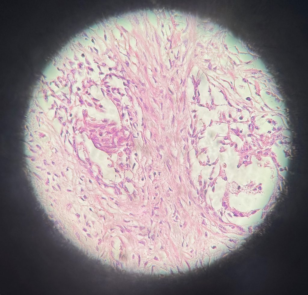 Prostata
